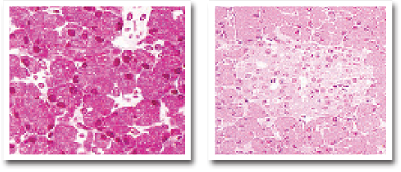 成年兔胰岛细胞（左）与成年人胰岛细胞（右）之显微照片比较
